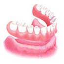 Thailand Dental Complete Dentures